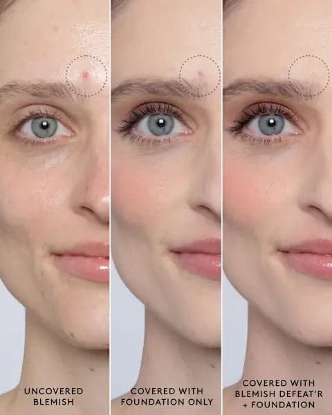 Fenty Skin Blemish Defeat