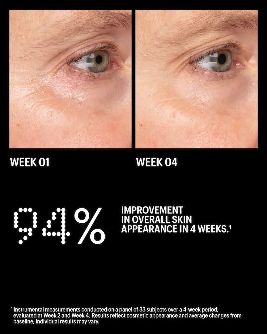 Side-by-side eye-area close-ups at week 01 and week 04 above a 94% overall skin appearance improvement claim