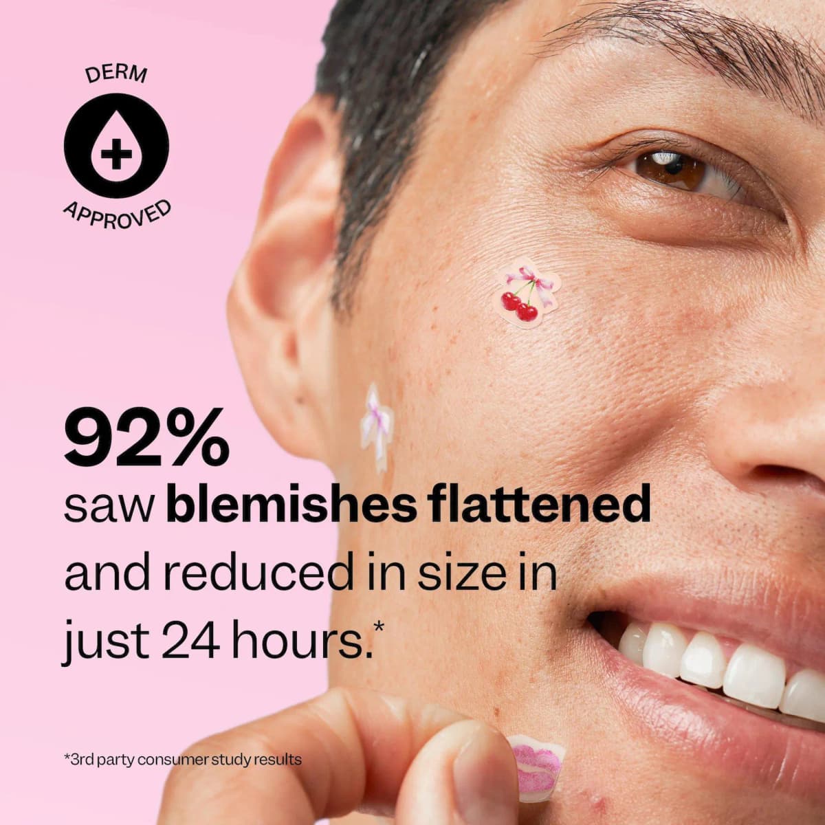 Close-up of a smiling model with cherry, bow and lips patches on the cheek; claims 92% saw blemishes flattened in 24 hours