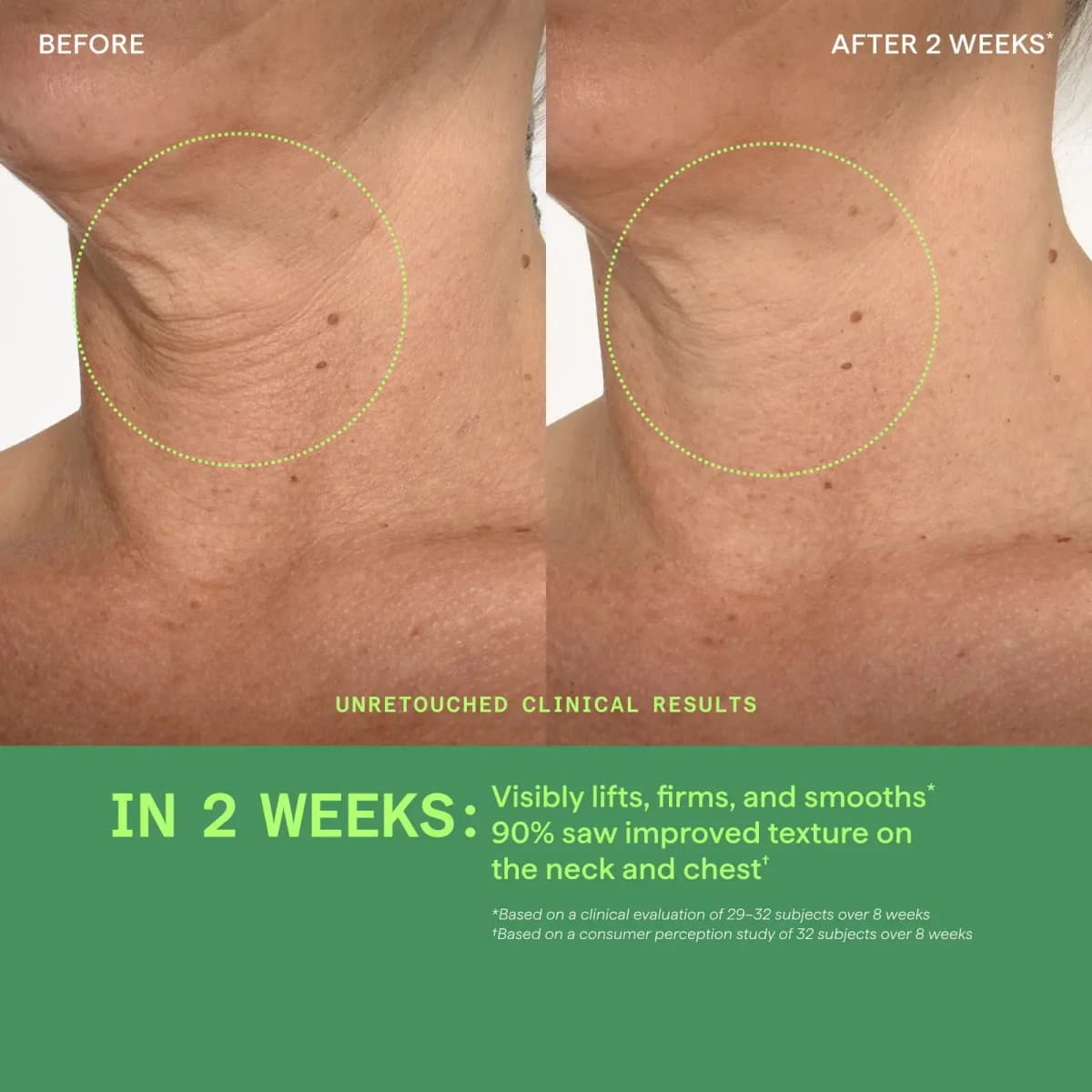 Side-view neck before and after 2 weeks showing smoother crepey skin, with stats on lifting and texture