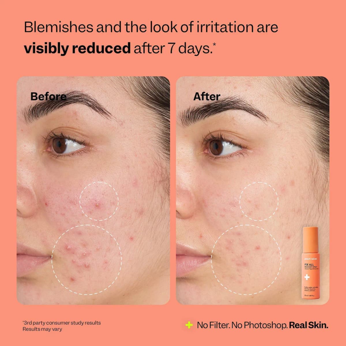 Before and after of a cheek with fewer red blemishes after 7 days, orange Fix All Recovery Spray on coral background