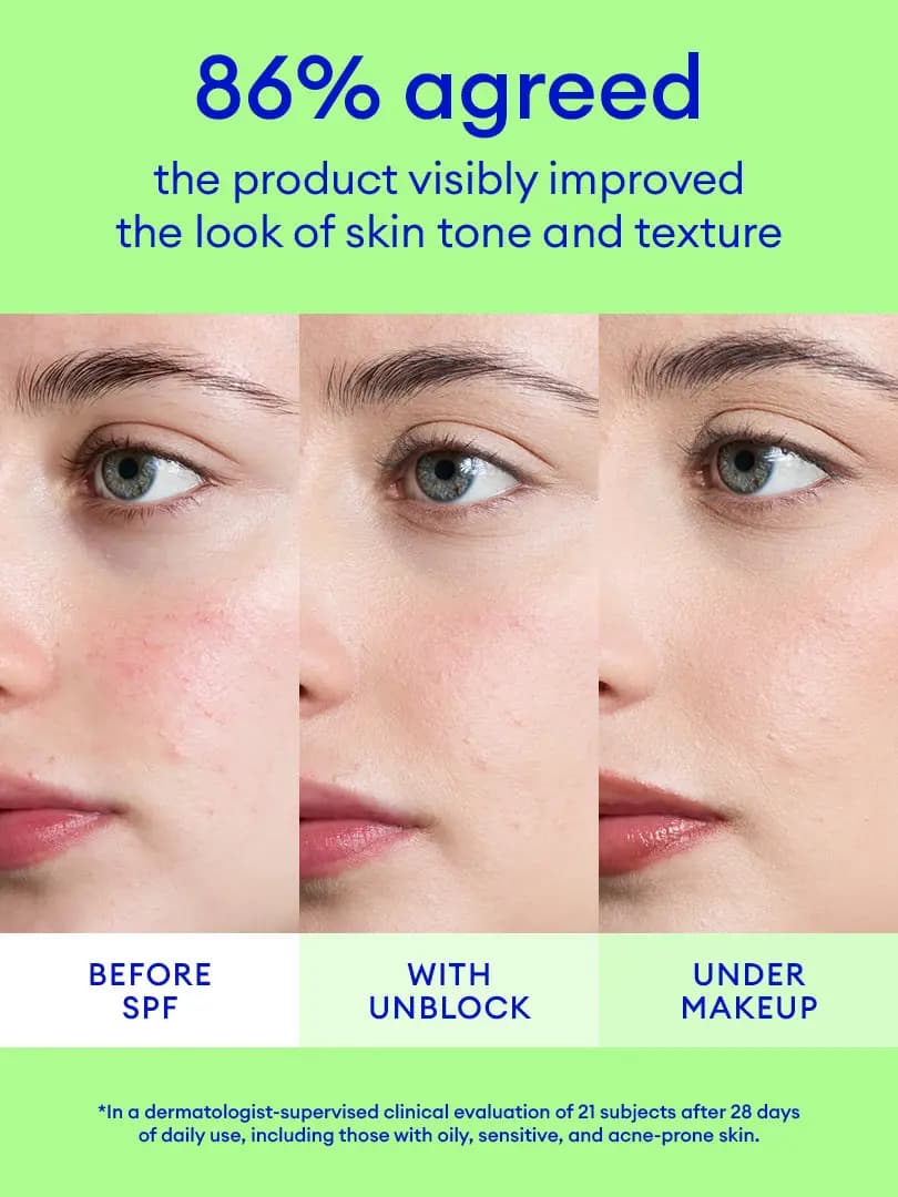 Close-up face of a woman before SPF, with Unblock and under makeup, showing reduced redness; 86% agreed tone improved
