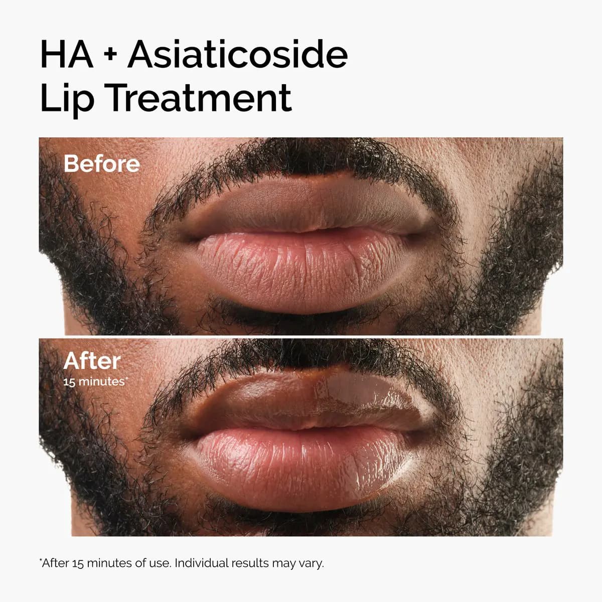 Bearded man's lips before and after 25 minutes, looking glossier, smoother and plumper