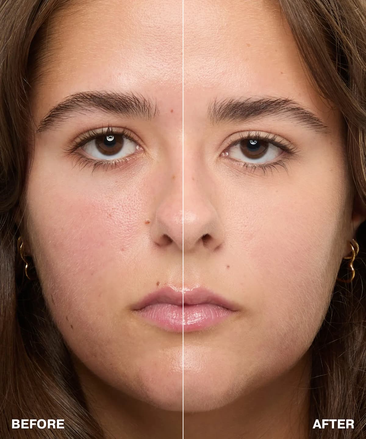 Before-and-after face split showing redness and blemishes evened out by the concealer on one side