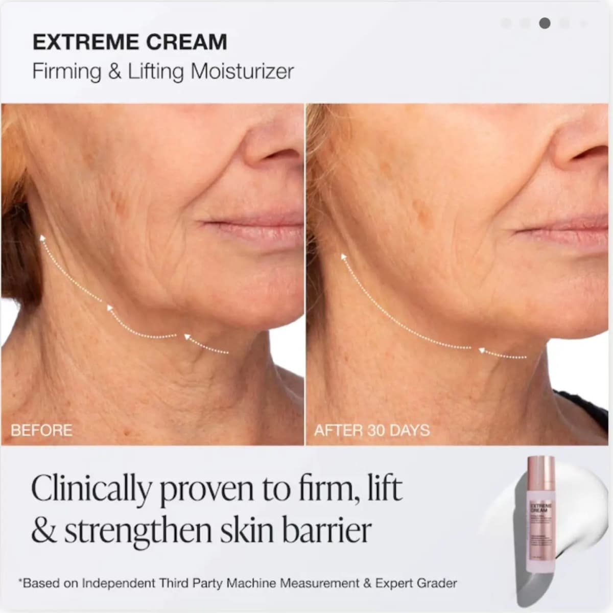 Before and after 30 days of Extreme Cream: close-up of jawline and neck with dotted arrows showing a lifted contour