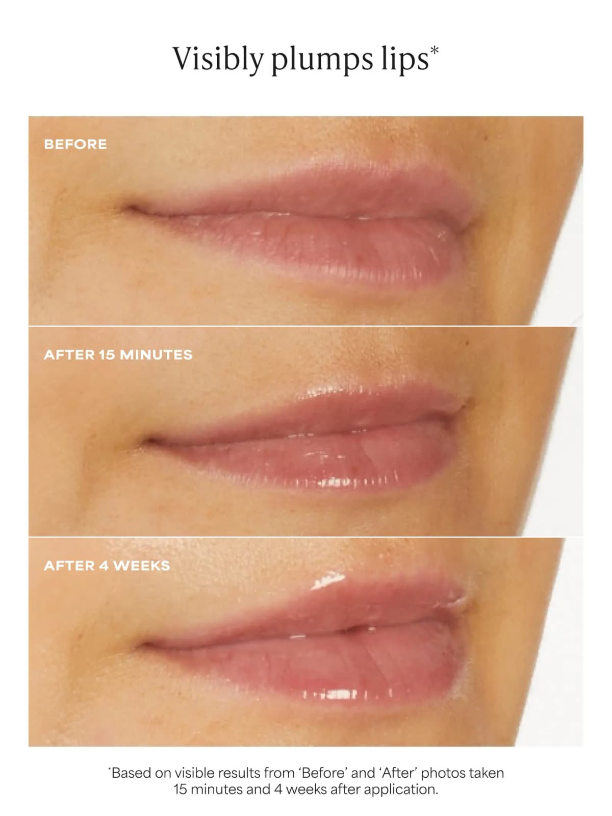 Before, after 15 minutes and after 4 weeks lip photos showing fuller, glossier lips