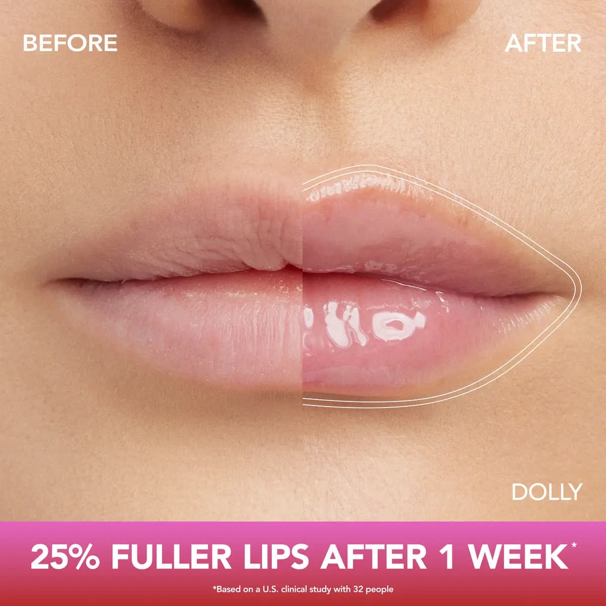 Before-and-after lip close-up in shade Dolly with the caption 25% fuller lips after 1 week, per a 32-person study.